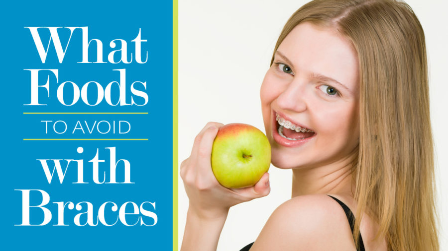 What Foods To Avoid With Braces