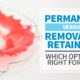 Permanent vs Removable Retainers