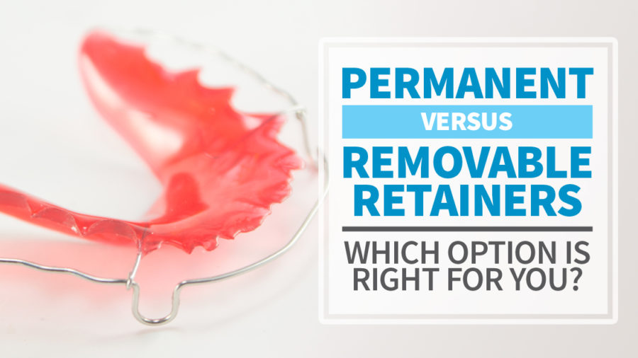 permanent vs removable retainers - which option is right for you - Midwest Orthodontics Center Chicago, IL