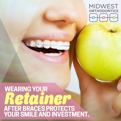 Braces-Protects your Smile and Investment