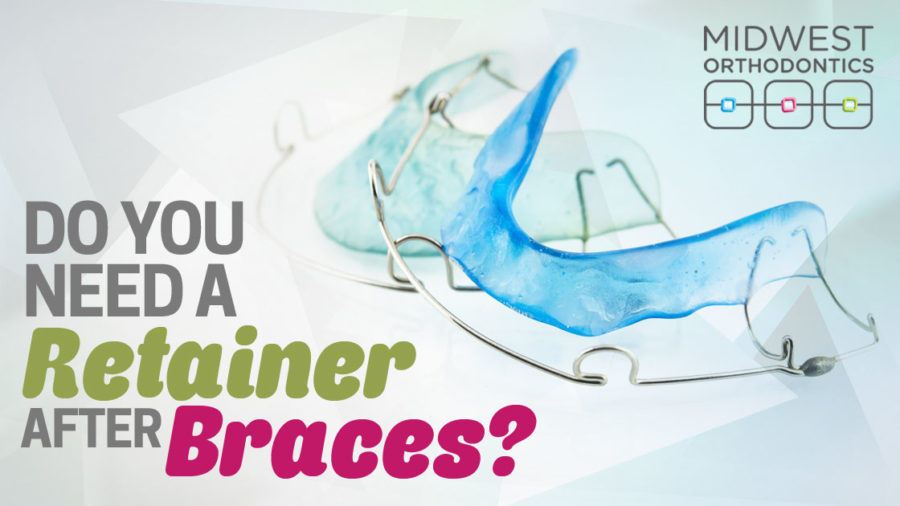 Do You Need a Retainer After Braces?