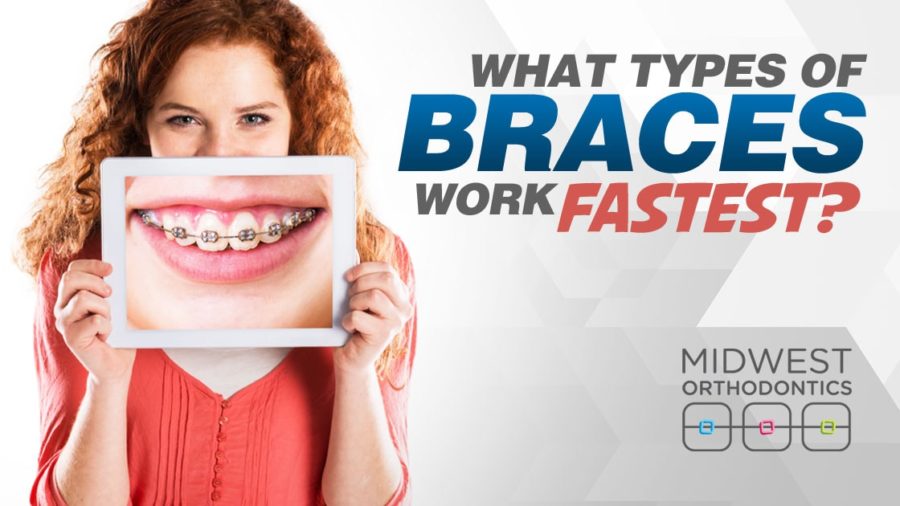 What Type of Braces Work the Fastest