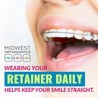 What to expect after braces: Wearing Retainer Daily