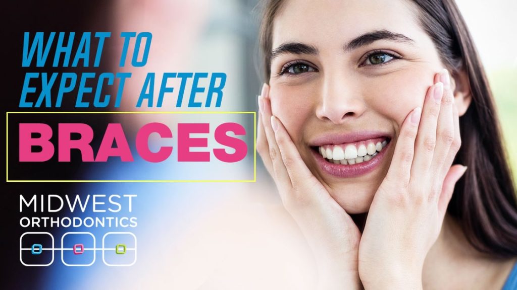 What To Expect After Braces Midwest Orthodontics Center Blog