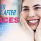 What to Expect After Braces