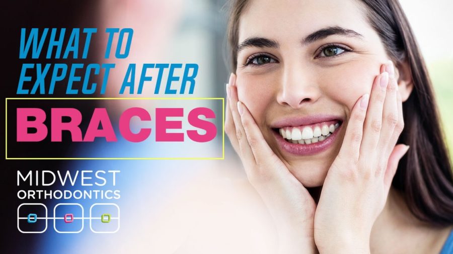 What to Expect After Braces