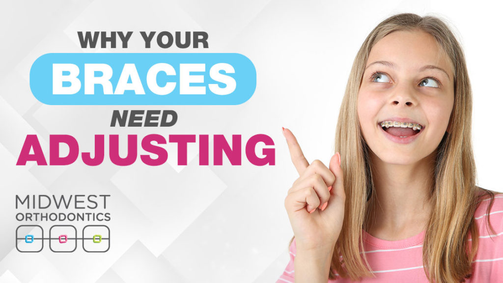 Why Do I Need My Braces Adjusted Midwest Orthodontics Center Blog