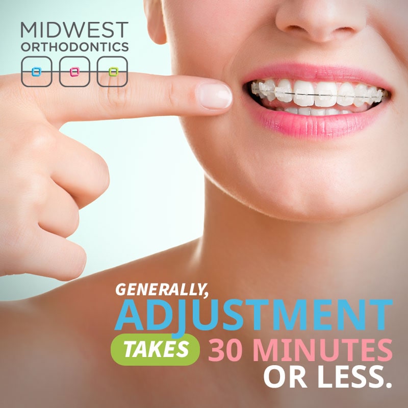 braces adjustments usually take 30 minutes or less